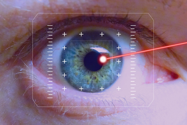 The laser in the treatment of the glaucoma: three uses